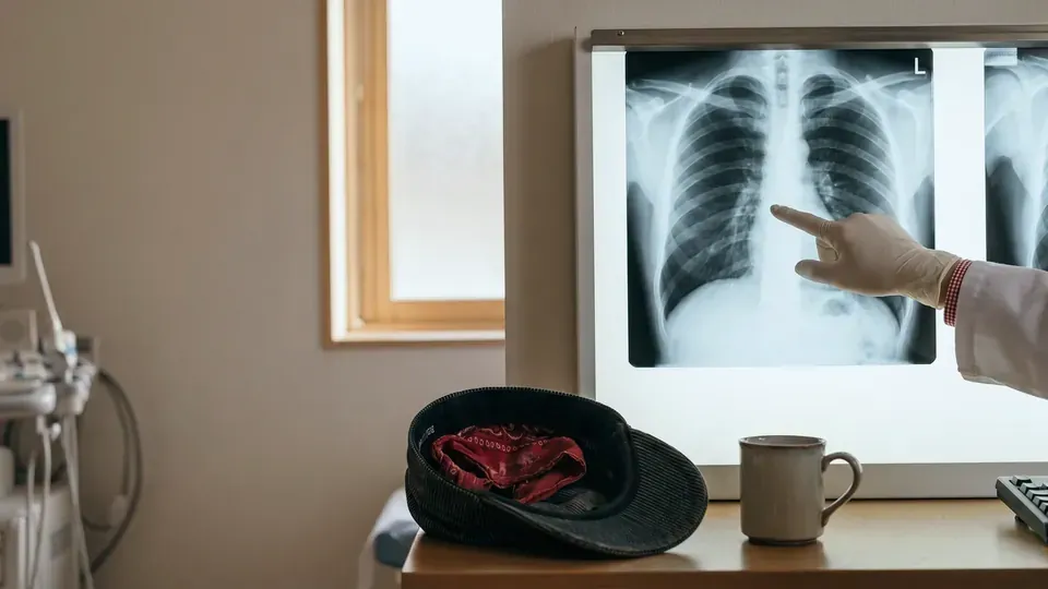 A doctor reviewing a retired railroad worker's chest x-ray for cancer