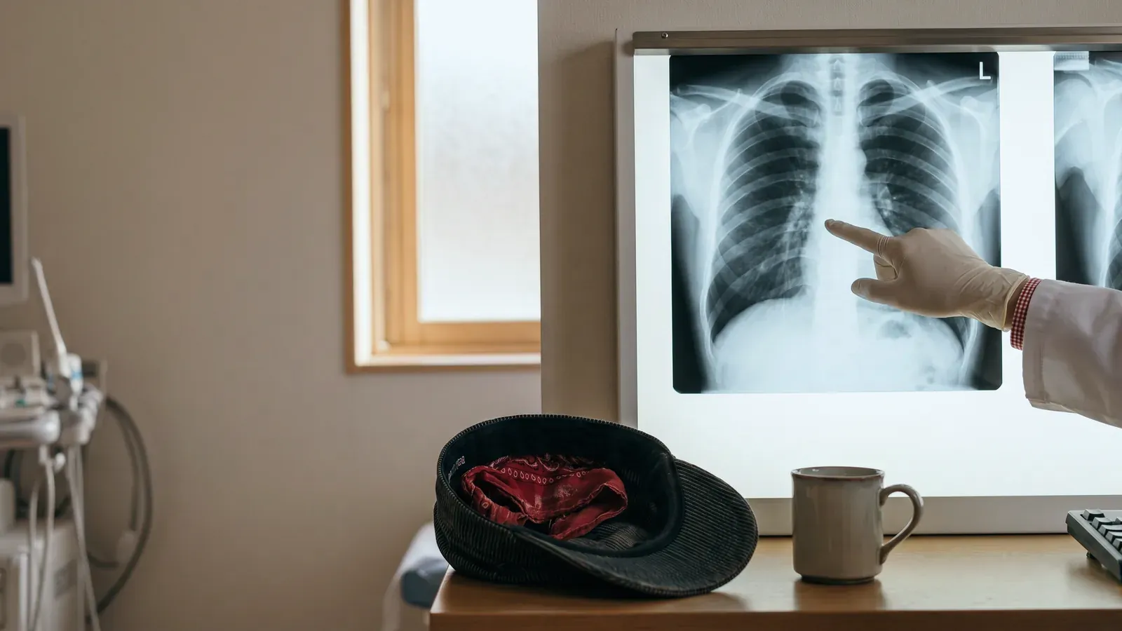 A doctor reviewing a retired railroad worker's chest x-ray for cancer